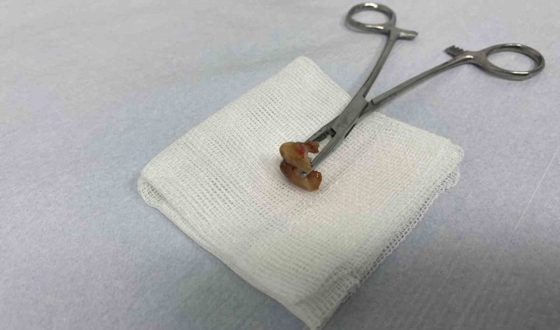 İstanbul’da yaşayan 41 yaşındaki adam, yoğun öksürük ve nefes darlığıyla