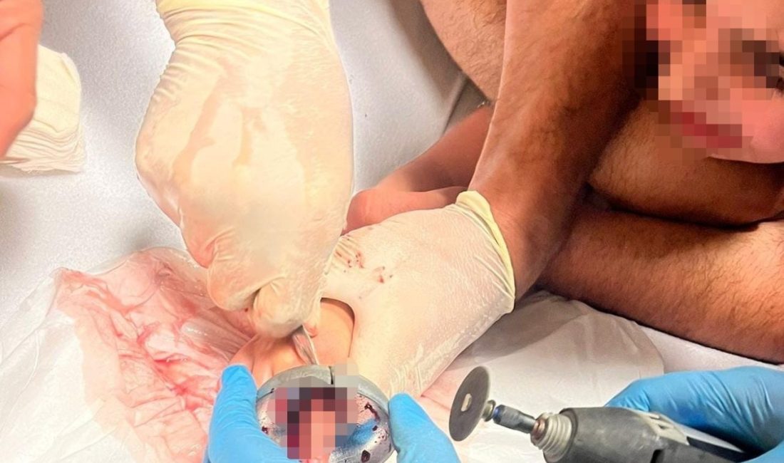 Bursa’da çocuğun parmağı çeşme aynasına sıkıştı Bursa’nın İnegöl ilçesinde parmağı çeşme aynasına sıkışan çocuğu itfaiye ekipleri