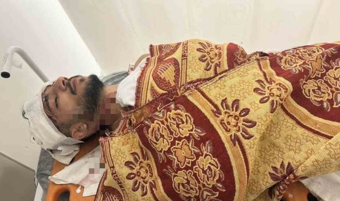 Arnavutköy’de yol verme tartışması kaza ile bitti: Kamyonet sürücüsü taksiye çarpıp kaçtı İstanbul’un Arnavutköy ilçesinde kamyonet sürücüsü ile taksi şoförü arasında yol