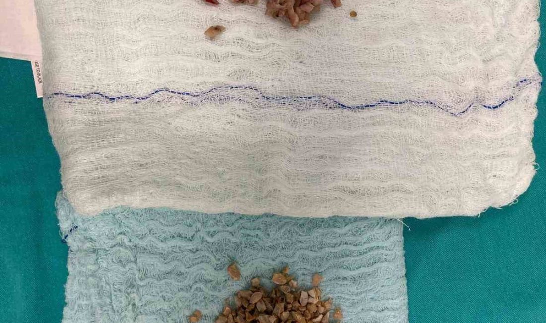 Bayburt Devlet Hastanesi Üroloji Polikliniğine başvuran 84 yaşındaki hastaya, prostat