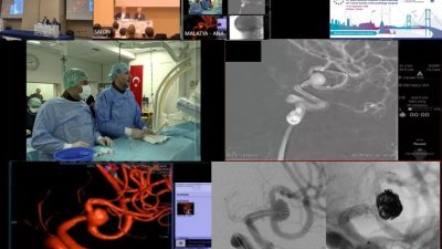 İstanbul’da 17-21 Eylül tarihleri arasında düzenlenen Asya ve Avrupa Nöroradyoloji