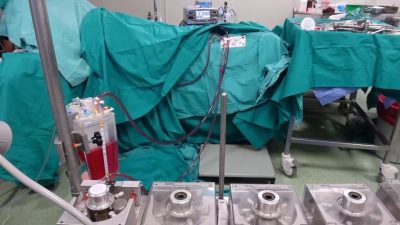 Elazığ Fırat Üniversitesi Hastanesi’nde Hipertermik Intraperitoneal Kemoterapi (HIPEC) yöntemiyle kanser