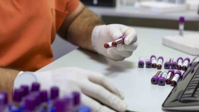 Dünyada 6 milyonda bir görülen olay gerçekleşti. İspanya’dan Türkiye’ye getirilen