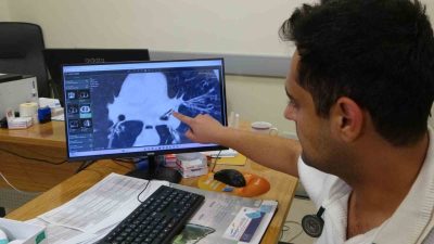 Malatya’da bir buçuk yıldır geçmeyen öksürük şikayetiyle birçok hastaneye başvuran