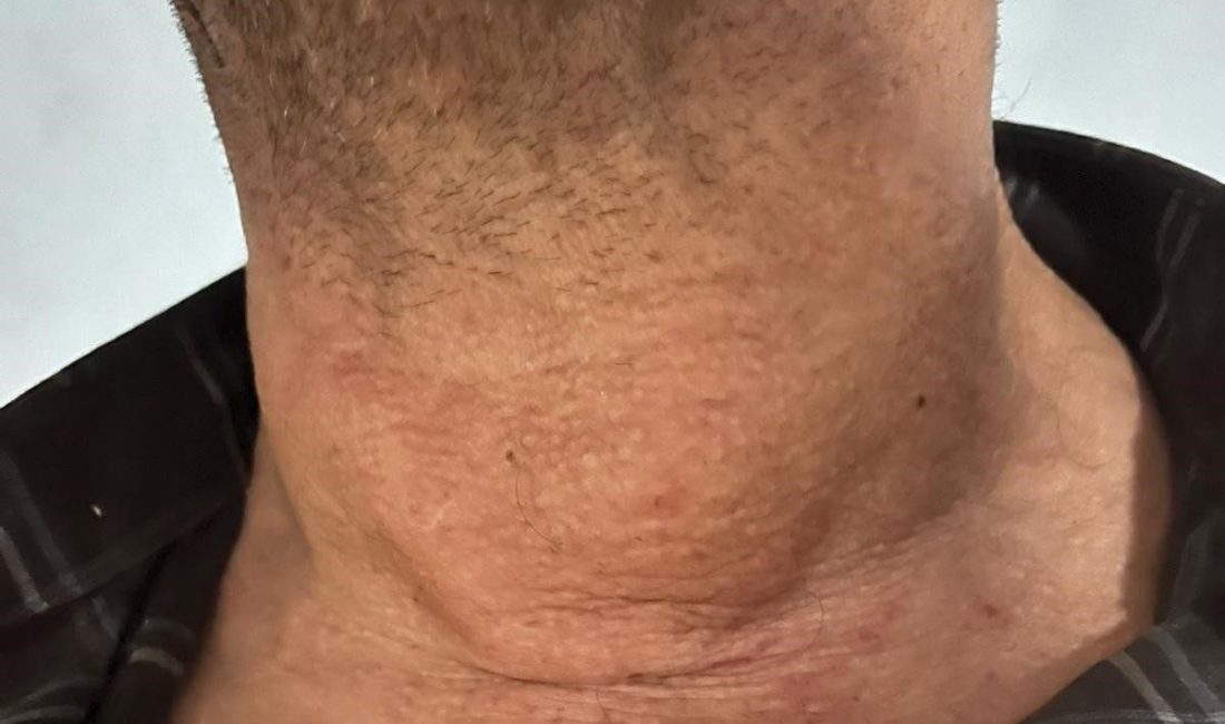 Kütahya Evliya Çelebi Eğitim Araştırma Hastanesi Girişimsel Radyoloji Biriminde olağanüstü