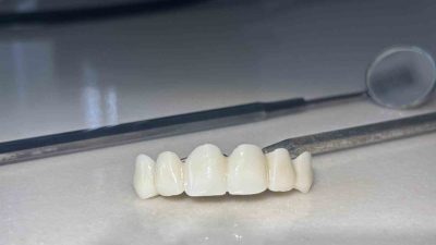 Sivas Ağız ve Diş Sağlığı Hastanesi, bakanlık onayı ile yeni