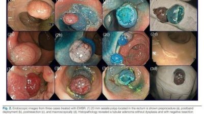 DENİZLİ (İHA) –Denizli’de İç Hastalıkları Anabilim Dalı Gastroenteroloji Bilim Dalı