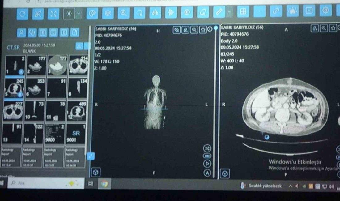 Sağlık Bilimleri Üniversitesi (SBÜ) Van Bölge Eğitim ve Araştırma Hastanesi’nde