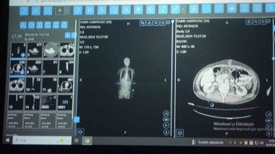 Sağlık Bilimleri Üniversitesi (SBÜ) Van Bölge Eğitim ve Araştırma Hastanesi’nde