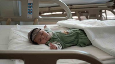 Doğuştan genetik hastalık nedeniyle 9 aylıkken yalnızca 4 kilo olan