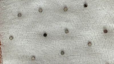 Elazığ’da 3 yaşındaki bir çocuğun yuttuğu 19 mıknatıs, Fırat Üniversitesi