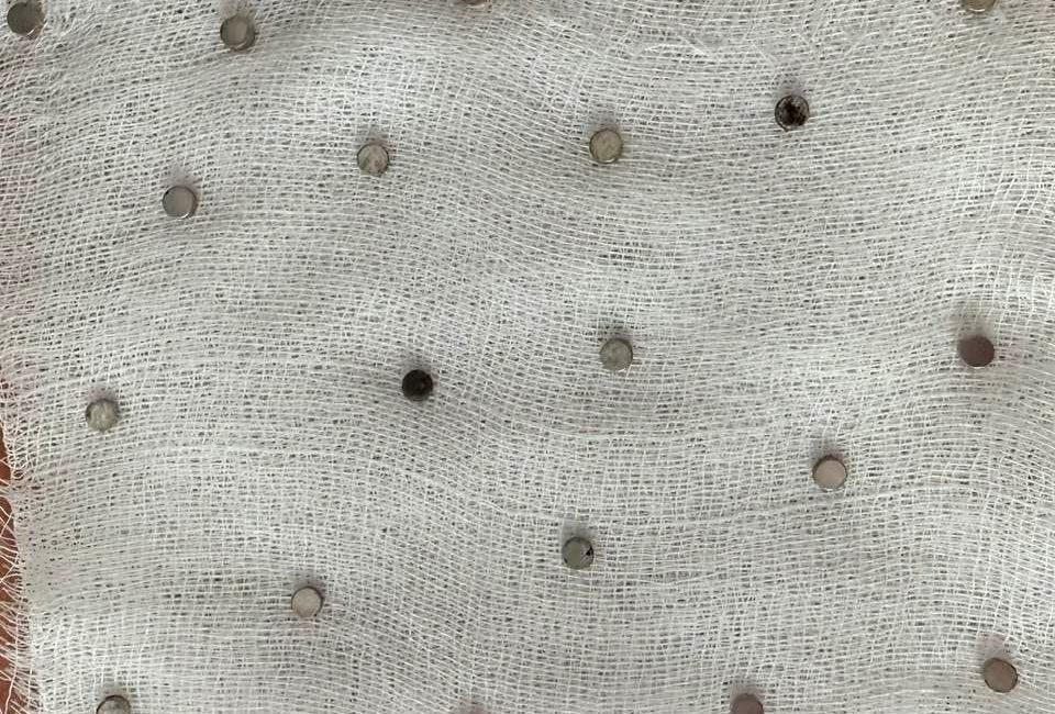 Elazığ’da 3 yaşındaki bir çocuğun yuttuğu 19 mıknatıs, Fırat Üniversitesi