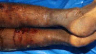 İsrail tarafından iade edilen Filistinlilerin cenazelerinde işkence izleri tespit edildi.