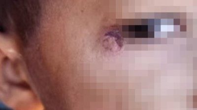 Şanlıurfa’nın Harran ilçesinde okulda öğrenciyi darp edip yüzünde sigara söndürdüğü