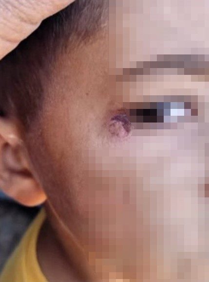 Şanlıurfa’nın Harran ilçesinde okulda öğrenciyi darp edip yüzünde sigara söndürdüğü