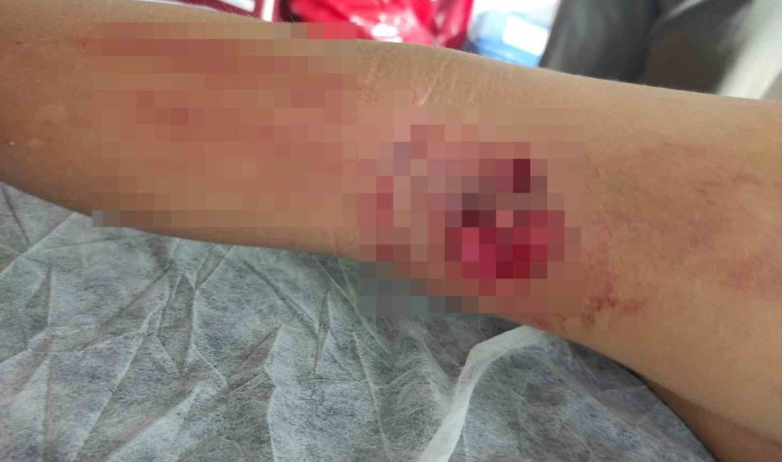 Okula giderken sokak köpeğinin saldırısına uğradı Orhangazi’ye bağlı Yeni Sölöz Mahallesi’nde sabah okula gitmek için evden