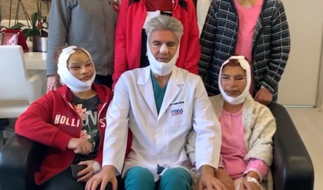 Ünlü estetikçi Prof. Dr. Hayati Akbaş’ın, yüz germe ameliyatı yaptığı